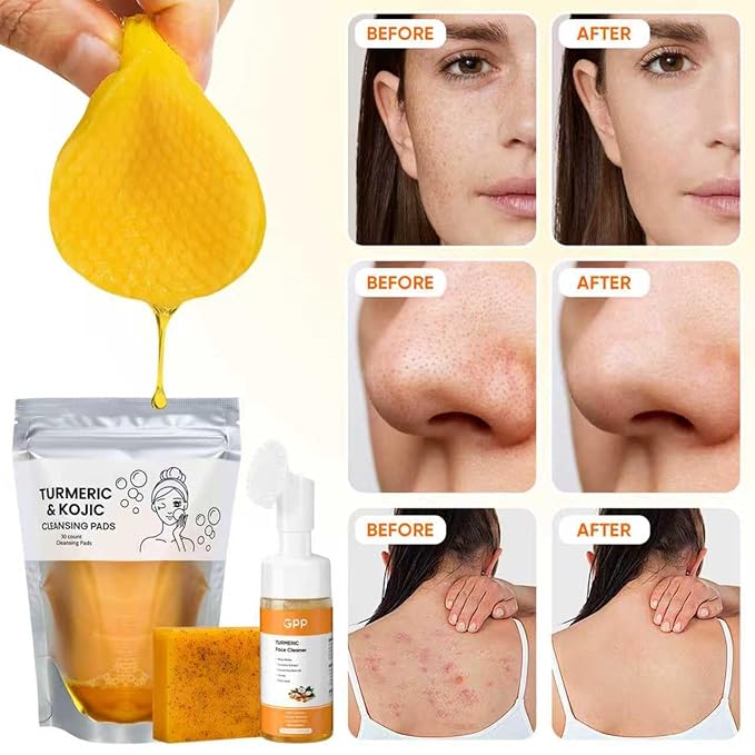 Turmeric Soap & Turmeric Face Wash & Cleansing Pads 30pcs Skin Care Set, Glow Turmeric for Face & Body, Lemon Tumeric Soap, Facial Cleanser Foam for Daily Cleansing, Turmeric Wash and Care 3 Piece Set