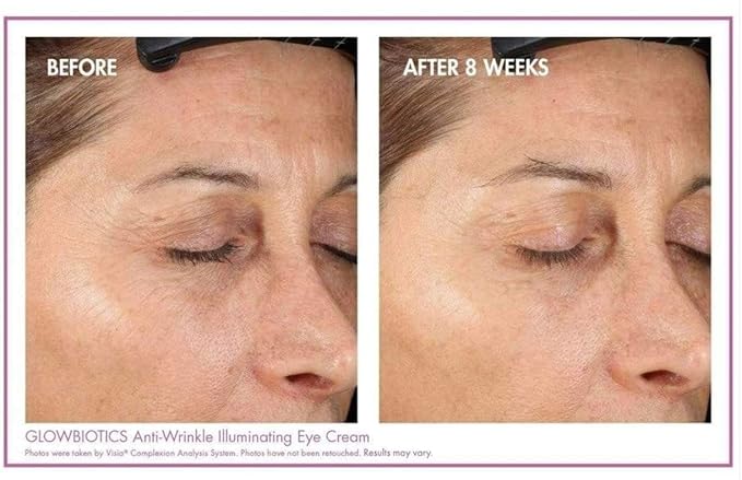 Glowbiotics Anti-Wrinkle Illuminating Eye Cream: Reduces Dark Circles, Puffy Eyes, Fine Lines & Wrinkles, With Probiotics & Antioxidants, 0.5 Fl Oz