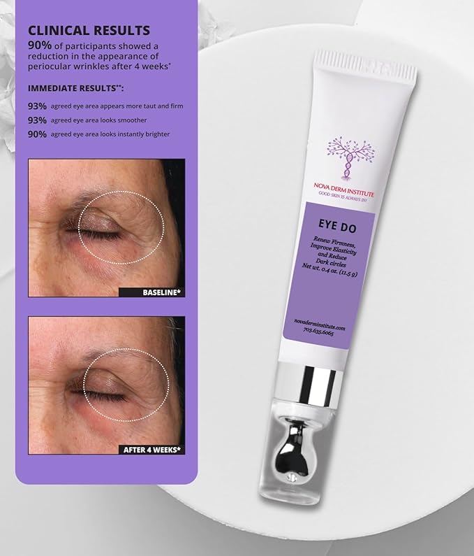 NOVA DERM EYE DO Eye Cream for Dark Circles – Anti-Aging Under Eye Cream with Peptides & Hyaluronic Acid, Non-Comedogenic (0.4 oz)