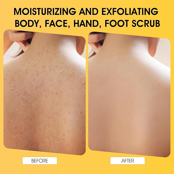VOERUY Turmeric Body Scrub, 10% AHA/BHA & Vitamin C Exfoliating Body Scrub, Body Exfoliator for Body Hand Foot Bikini Area, Smooth & Moisturized Skin for Women and Men - 11.3oz