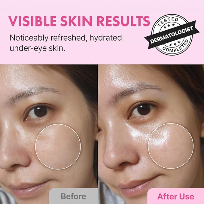 Hanskin Hyaluron Eye Serum – Korean Hydrating Eye Care | 4 Types of Hyaluronic Acid & Cooling Metal Applicator | De-Puffing, Smoothing & Brightening for Tired, Dry Skin | 0.85 fl oz