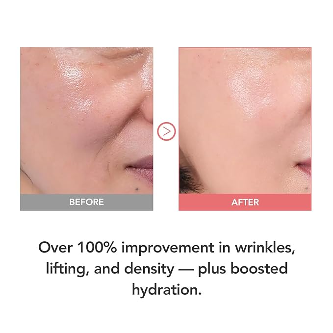 107% Smoother Crow’s Feet & 104% Lifted Skin – Boosts Elasticity & Moisture – Firms & Restores Radiance with 10% Collagen Water & Hyaluronic Acid – Korean Skincare Best Collagen Cream