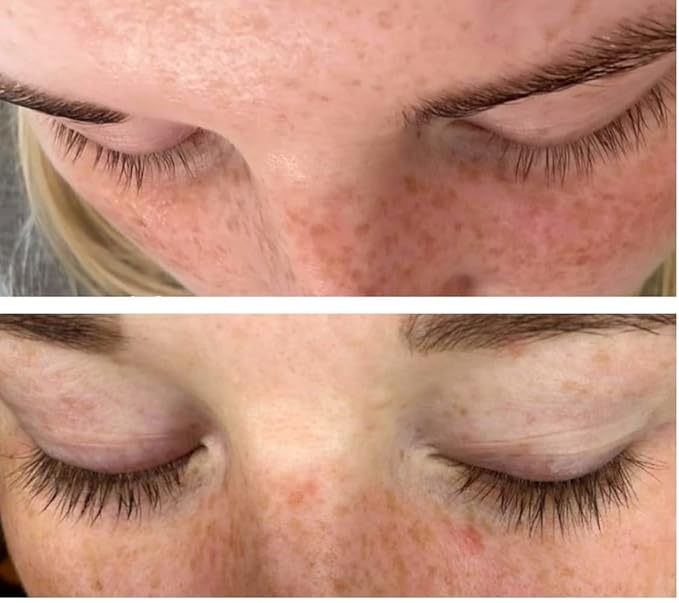 Lash & Brow Growth Serum, Quick Results, All Organic Ingredients, Vegan Friendly, Cruelty Free, Oil Free