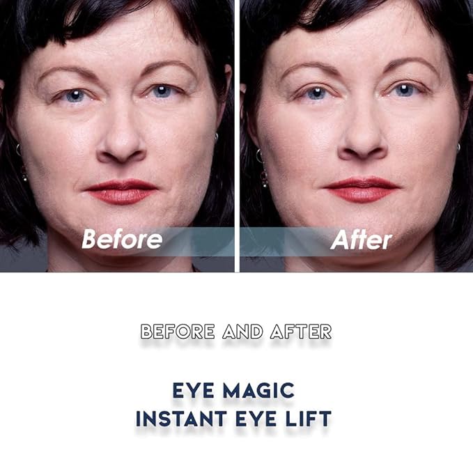 Eye Magic Premium Original Eye Lift Kit - Medium-Kit Size, 64 Count, Strips + Wax/Gel, Original Premium Kit, Made in USA