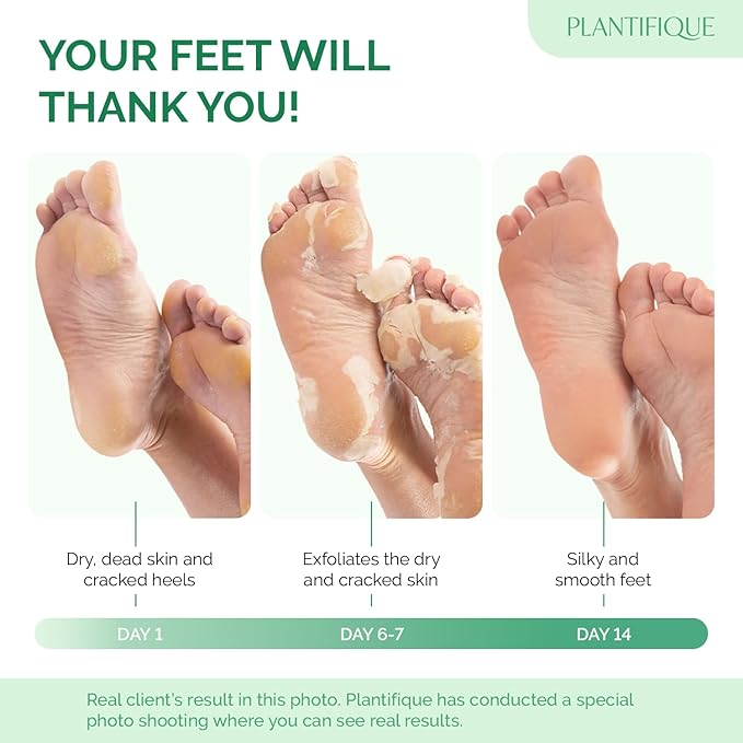 PLANTIFIQUE Foot Peeling Mask - Peeling Foot Mask Dermatologically Tested Repairs Heels & Removes Dry Dead Skin for Baby Soft Feet (Jasmine, 1 Count (Pack of 1))