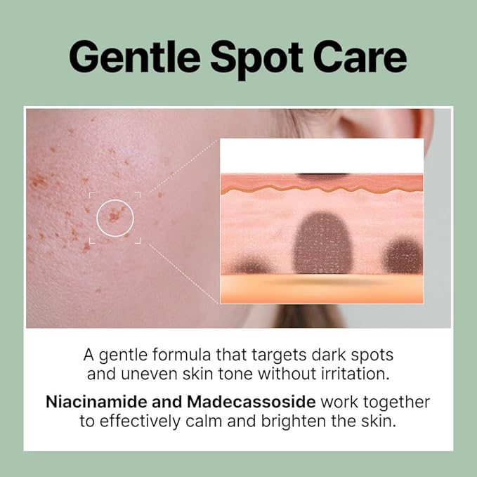 FRANZ Invisible Dark Spot Pimple Patches for Acne Marks, Thin Makeup-Friendly Pimple Spot Treatment with UV Protection - 12 Patches