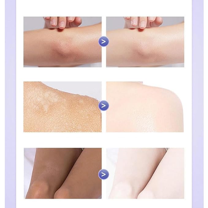Skin 𝐖𝐡𝐢𝐭𝐞𝐧𝐢𝐧𝐠 Body Lotion-Japanese 𝐖𝐡𝐢𝐭𝐞𝐧𝐢𝐧𝐠 Cream, Cold White Skin All Over Cream, Cold White All Over Lotion the Body, Long Lasting Hydration