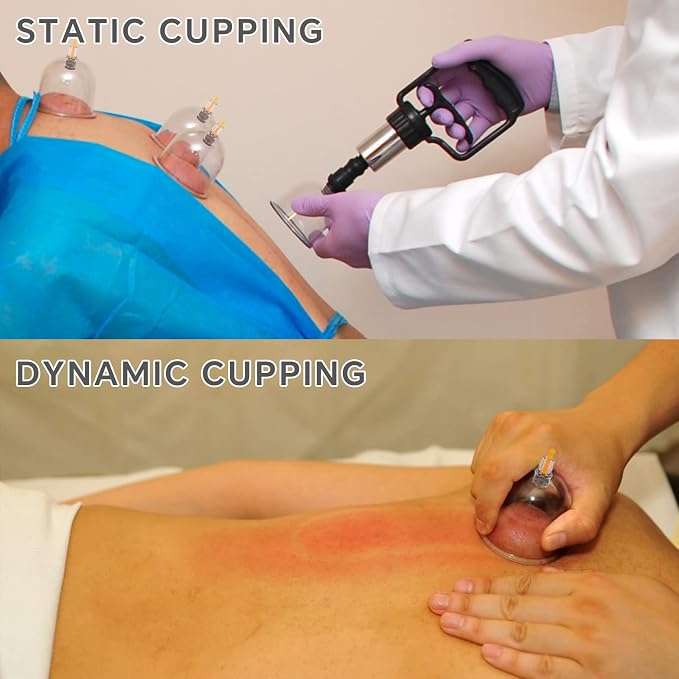 Cupping Kit for Massage Therapy Set with Pump 12 Massage Cups for Cellulite Reduction Muscle Back Pain Relief Physical Therapy