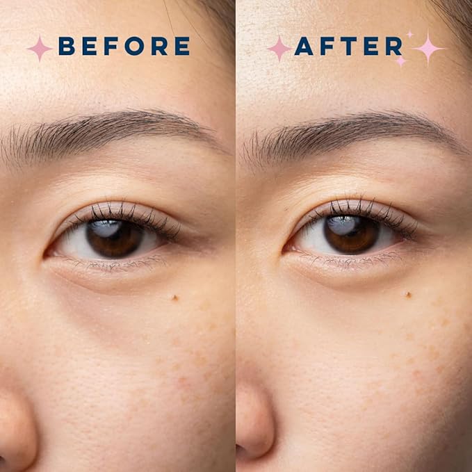 CLEAN SKIN CLUB Brightening+ Stem Cell Eye Cream, Reduces Dark Circles & Puffiness, Fragrance Free, 1.2 fl oz (Pack of 1)