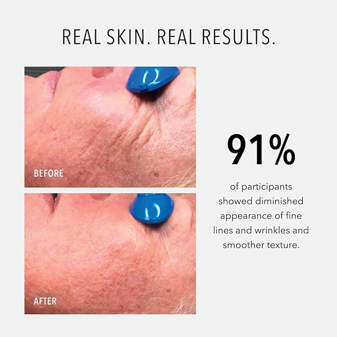 HydroPeptide Nimni Cream, Patented 0.25% Retinol Collagen Support, Anti-Aging Booster Cream, Improves Skin's Fullness and Elasticity, 0.5 Ounce