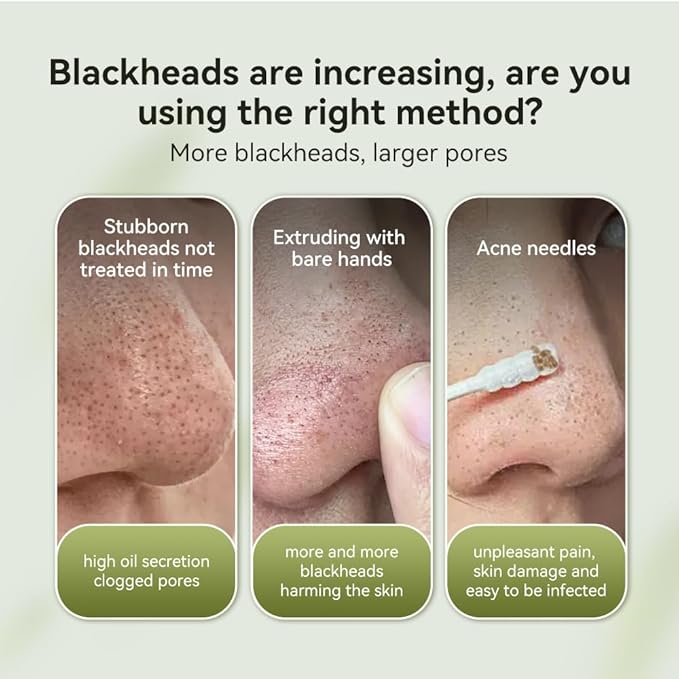 LANBENA Blackhead Mask, Nose Plants Pores Strips Blackhead Remover Mask Peel off Mask Facial Pore Cleanser Purifying Face Mask Nose Strips (1.06 Ounce) - White