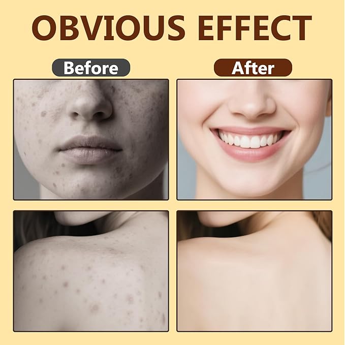 Bee Venom Skin Treatment Cream, Effective Skin Care, Bee Venom Cream with Natural Formula, Quickly Absorbing Moisturizer Suitable for All Skin Types, 2.1 fl oz