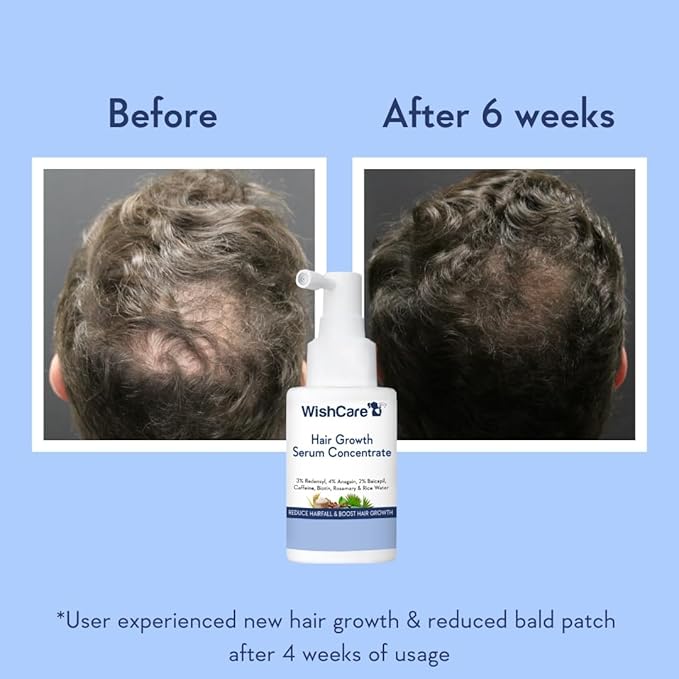 WishCare Hair Growth Serum Concentrate - Rosemary, 3% Redensyl, 4% Anagain, 2% Baicapil, Caffeine, Biotin, Plant Keratin & Rice Water