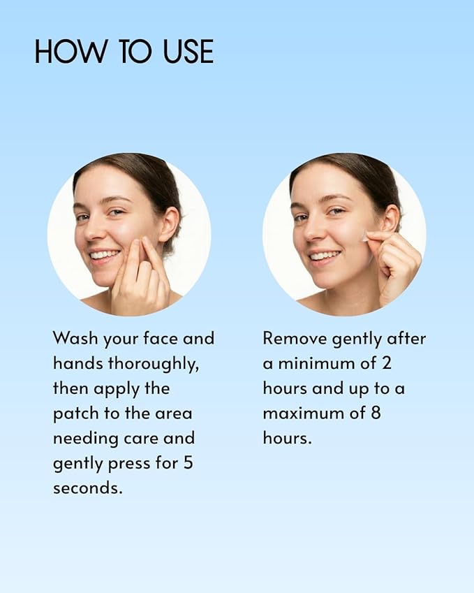 le dalcom Korean Micro-darts Patch, Early Stage Blemish Patches, Acne Care, Salicylic Acid, Tea Tree & Cica, Individual Blister Package (6 Patches)