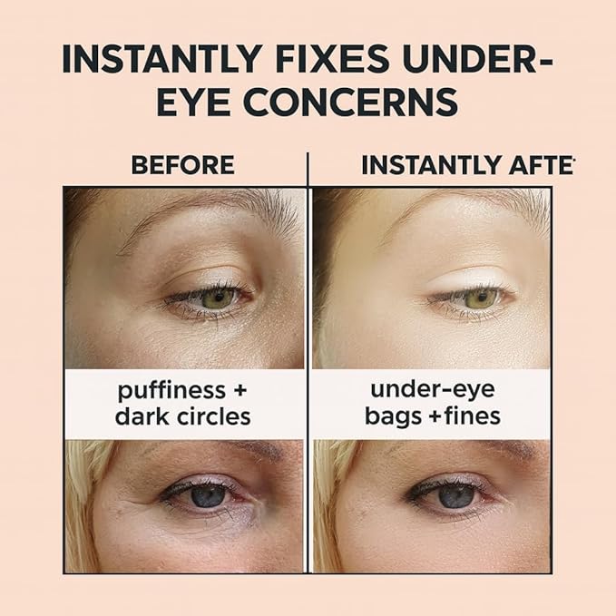 Instant Eye Firm & Face Tightening Primer – Advanced Eye Tightener Serum for Under-Eye Bags, Wrinkles & Fine Lines | With Double brush – 1 oz / 30ml