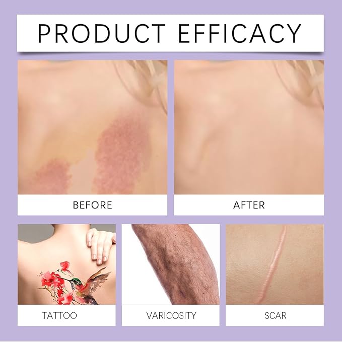 Body Concealer - Multi-Effect Full Coverage For Tattoos, Scars, And Varicosities, Light Makeup, Long-Lasting Formula, 100ML
