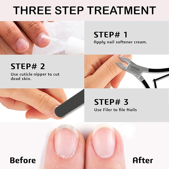 Professional Cuticle Trimmer Nail Cuticle Cutter Stainless Steel Cuticle Nippers with Sharp Blades of Cuticle Remover Clippers Manicure Tools Double Spring - Pedicure Nail Tools (Black - 4 Pack)
