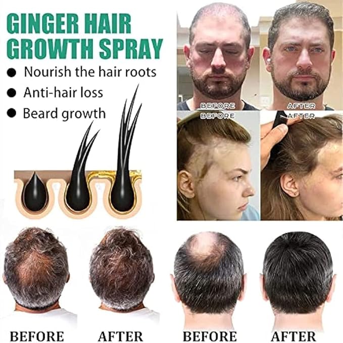 Shougagro Japanese Hair Growth Ginger Spray for Men Women, HyunGang Korea Ginseng Hair Regrowth Serum Spray, (3 Pcs)