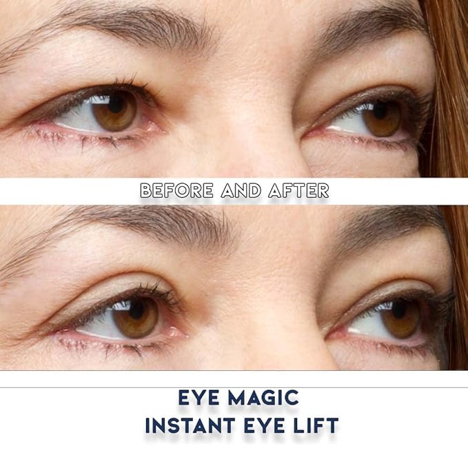 Eye Magic Premium Eye Lift Strips - Medium Size, 80 Count Refill Pack, Strips Only (no Gel), for Droopy, Sagging, or Hooded Eyelids, Hypoallergenic, Strong Hold, Made in USA