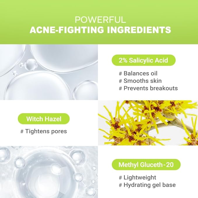 2% Salicylic Acid (BHA) Serum for Acne & Blackheads - Unclogs Pores, Oil Control, Sensitive-Skin Safe, Fragrance-Free,1 fl.oz