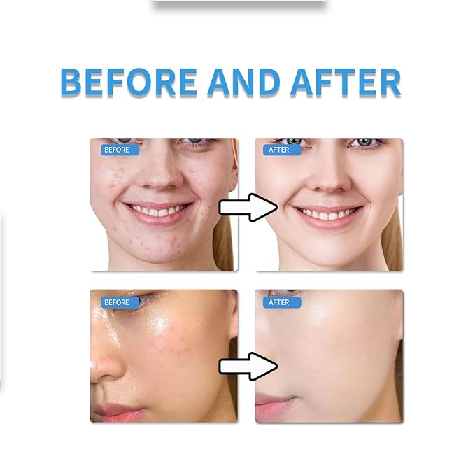 Mtmult Youthful Formula Facial Moisturizer with Niacinamide & Hyaluronic Acid - Face Cream for Deep Hydration, Infused with Centella Asiatica & Collagen - Daily Moisturizer for Youthful Skin