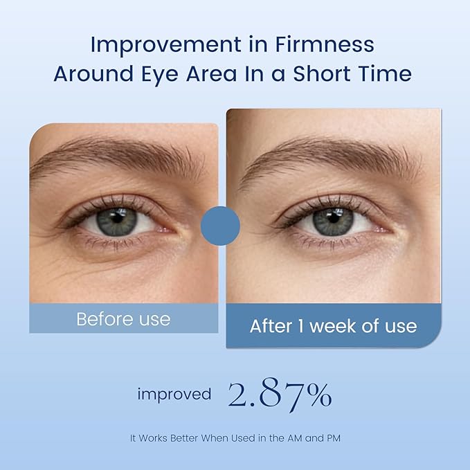 Eye Cream with Retinol Hyaluronic Acid & Niacinamide,3-in-1Eye Serum for Under Eye Bags & Puffiness Remover,Dark Circles,Wrinkles,Fine Lines,Hydrating & Brightening Eye Treatment for Men Women