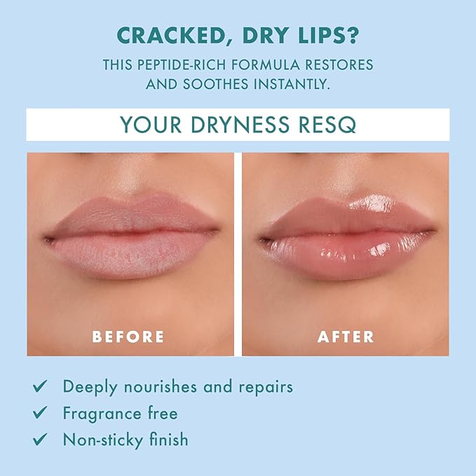 Skin ResQ by Petal Fresh Hello Hydration Lip Treatment – Made in Korea – Multi-Peptide Complex 3% + Shea Butter – For Dry, Chapped Lips – Fragrance Free, Deeply Hydrates & Smooths – 0.35 oz (10 mL)