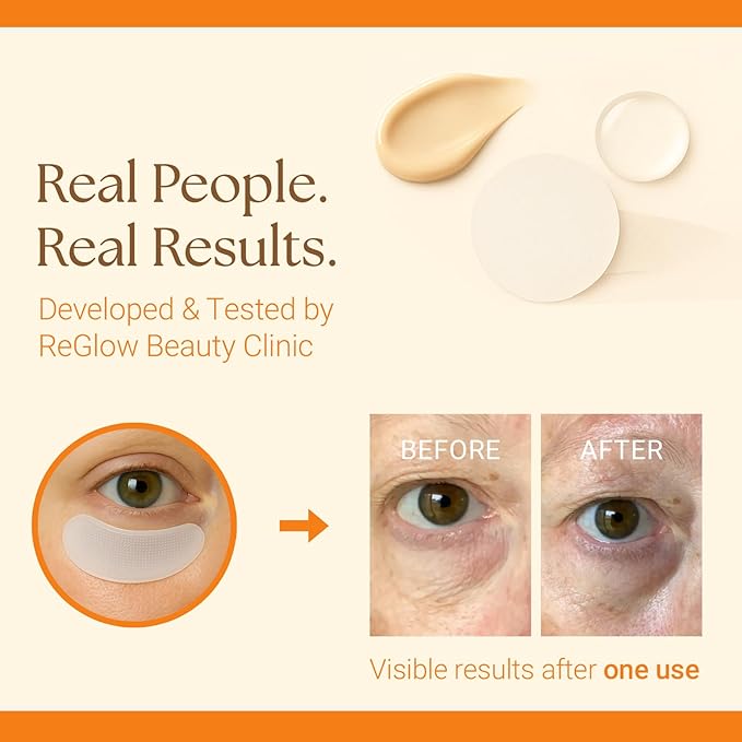 ReGlow Restore Microneedle Eye Patches for Immediate Wrinkles Reduction - Anti-Aging Under Eye Mask with hyaluronic acid - Collagen & Peptides - Reduce Dark Circles Puffiness & Fine Lines - 4 Pairs