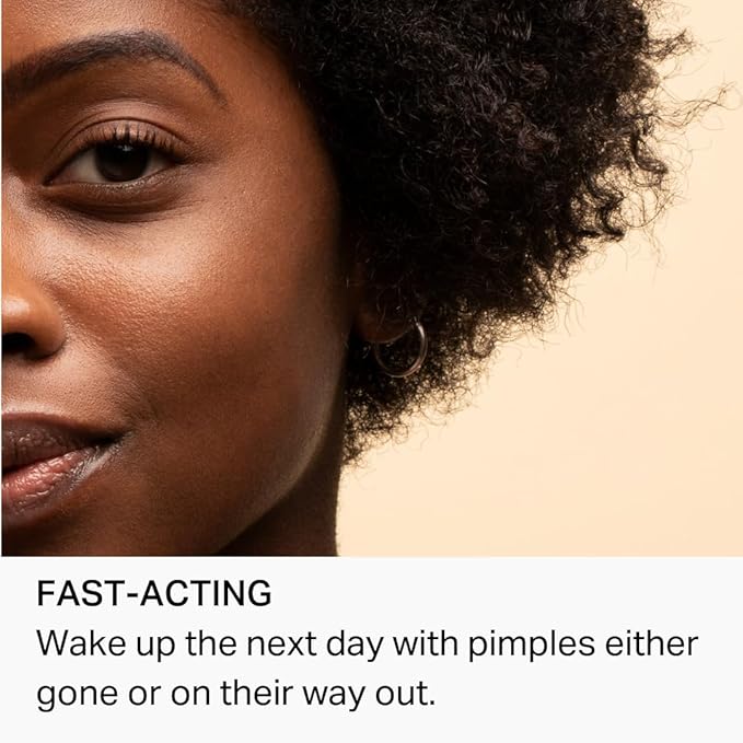 Y'OUR Acne Drying Spot Treatment | Shrink & Detoxify Pimples | Gentle with Salicylic Acid and Bentonite Clay | Vegan & Fragrance-Free | Suitable for Sensitive Skin | 20ml (0.67 oz.)