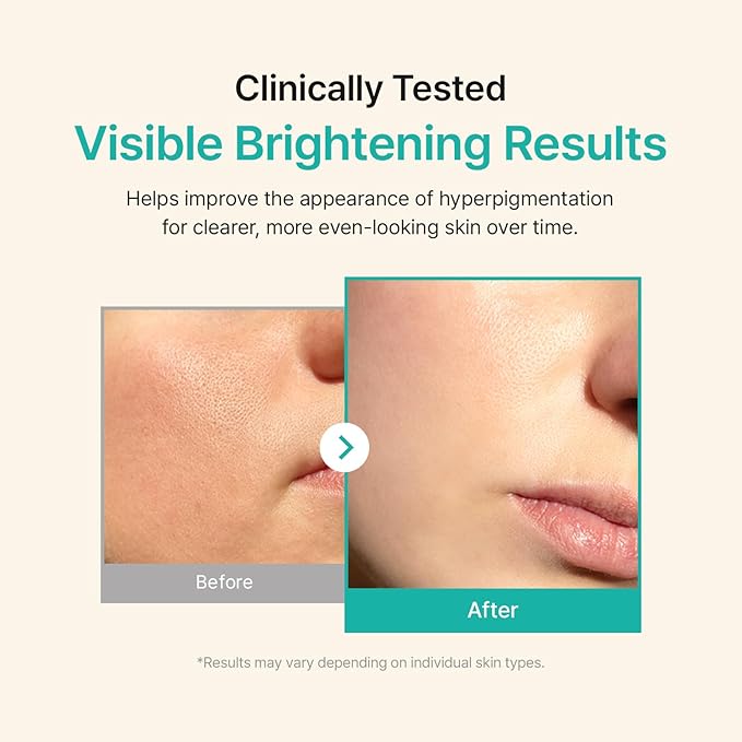ACWELL Licorice pH Balancing Advanced Facial Serum Ampoule – Dark Spot & Uneven Tone Care with Niacinamide, Lightweight Hydrating Daily Serum for Glass-Skin Glow, 1.01 fl. oz