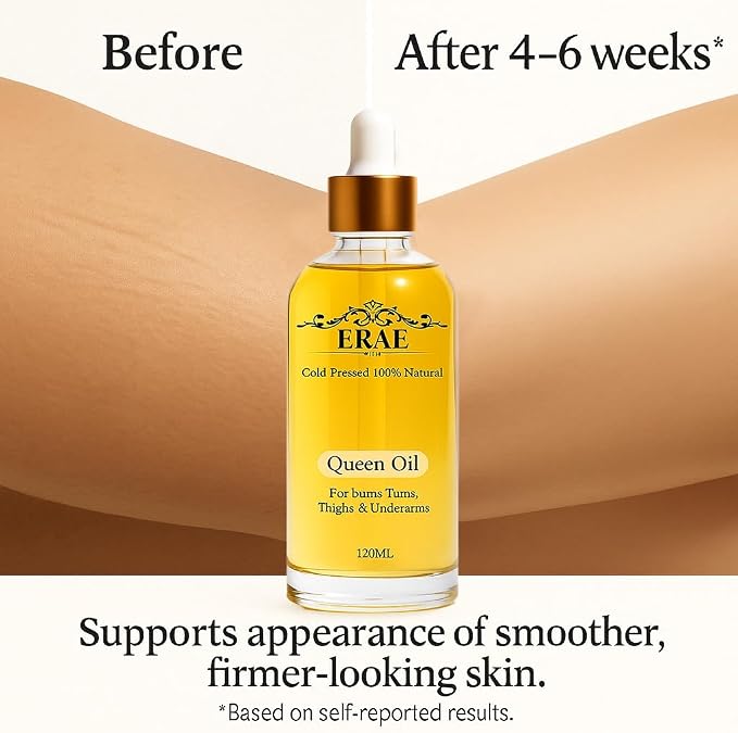 Erae Queen Oil – Cold-Pressed Natural Botanical Firming Oil for Face & Body – Hydrates Tightens & Restores Elasticity for Crepey, Aging & Menopausal Skin on Arms, Tummy & Thighs, 4 fl oz (1PCS)