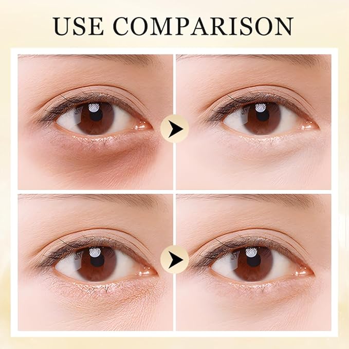 Serum Stick for Under Eye Bags,2025 New Turmeric Eyes Cream Deeply Moisturizes Eyebalm,Eye Balm Stick for Reduces Puffiness and Fine Lines (2)