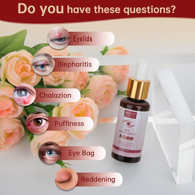 Styes Eye Relief Serum, 30ml Moisturize Blepharitis & Chalazion Remover, Gentle Under Eyelid Serum For Dark Circles, Puffiness.