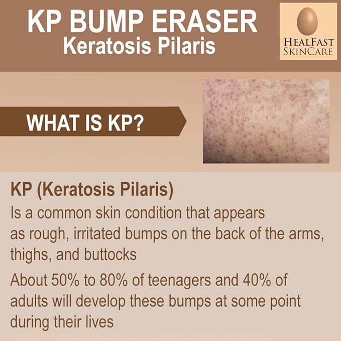 HealFast KP Bump Eraser Bodywash – Soften, Exfoliate, Nourish Rough and Bumpy Skin with 3% BHA – Keratosis Pilaris - For All Types – No Scrubbing Required – Fragrance and Paraben Free