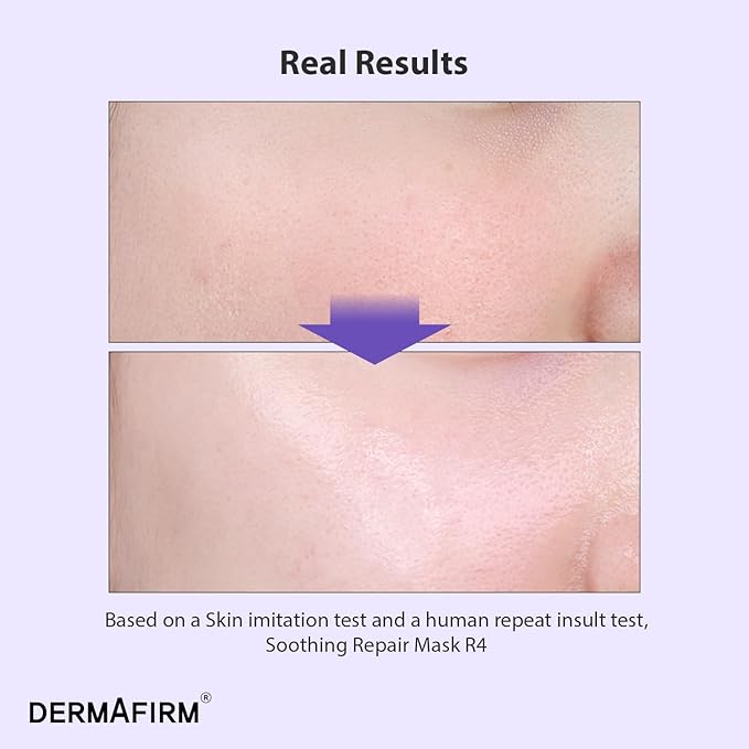 Dermafirm Soothing Repair Face Mask Sheets R4 | Hydrating Essence Leave-On Korean Facial Mask with Eucalyptus, Peptide and Collagen | Gentle on All Skin Types No Animal Trials No Paraben (5 EA, 1 oz)