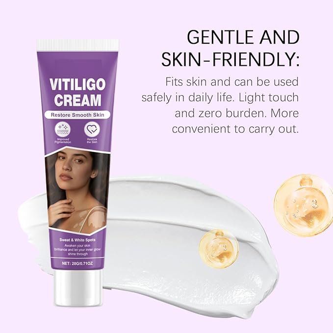 Vitiligo Cream, Vitiligo Treatment Cream， Reduce White Spots，Easy to Use