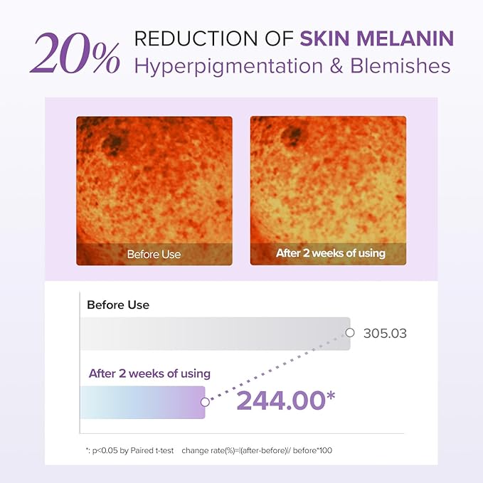 Mary&May Tranexamic Acid + Glutathione Eye Cream Set (1,000ppm each) – Brightening Under Eye Cream for Dark Circles & Uneven Tone, Vitamin C, Niacinamide – 1.01 oz + 0.4 oz Mini x2