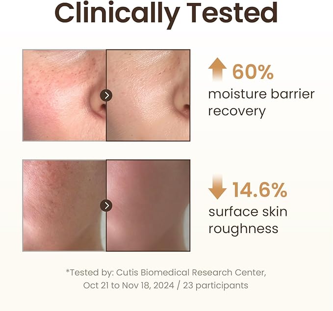 Essence Toner (150ml / 5 fl oz) – 86% Ginger Shot Water for Redness Relief, Hydration & Pore Care | Korean Skincare with Niacinamide, Peptides & Panthenol for Sensitive, Dull Skin