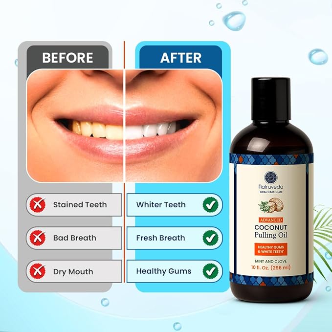 Natruveda Coconut Oil Pulling Mouthwash – 40 oz (Pack of 4), Extra Virgin Coconut Oil, Mint Flavor, Oil Pulling for Teeth & Gums, Natural Mouthwash, Whitening Oral Rinse, Ayurvedic Pulling Oil