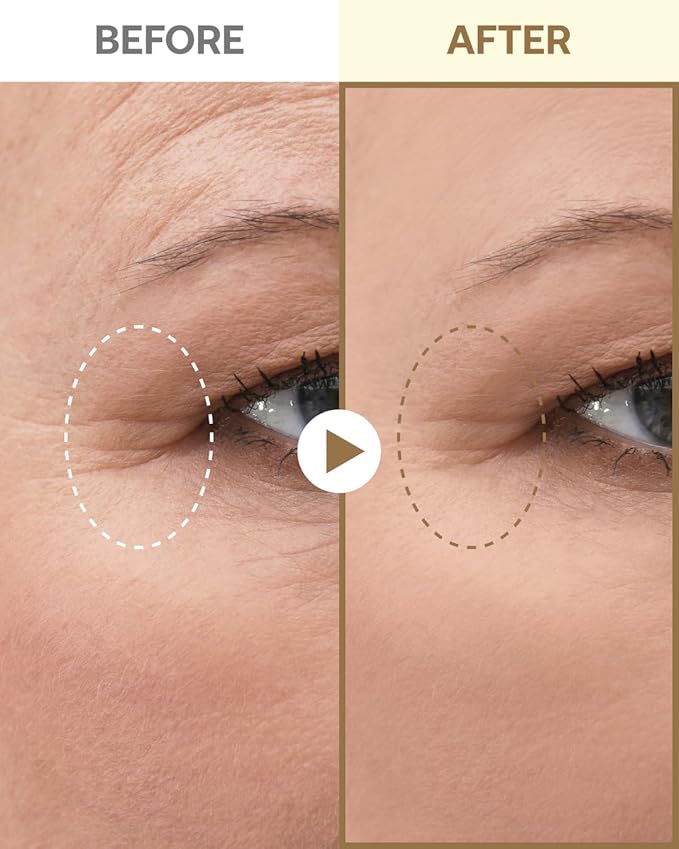 Geumsan Black Ginseng Peptide Under Eye Patches for Dark Circles & Wrinkles 2 Patches, Hydrocolloid Eye Mask for Firming & Hydration, Korean Skincare, Deep Absorption Technology