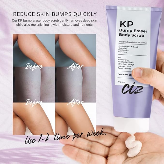 KP Bump Eraser Body Scrub: Exfoliating Keratosis Pilaris, Strawberry Skin Treatment - Smooths Rough, Bumpy, Dry Skin on Arms, Legs, Buttocks - KP Scrub Wash Helps Reduce Ingrown Hair Bumps