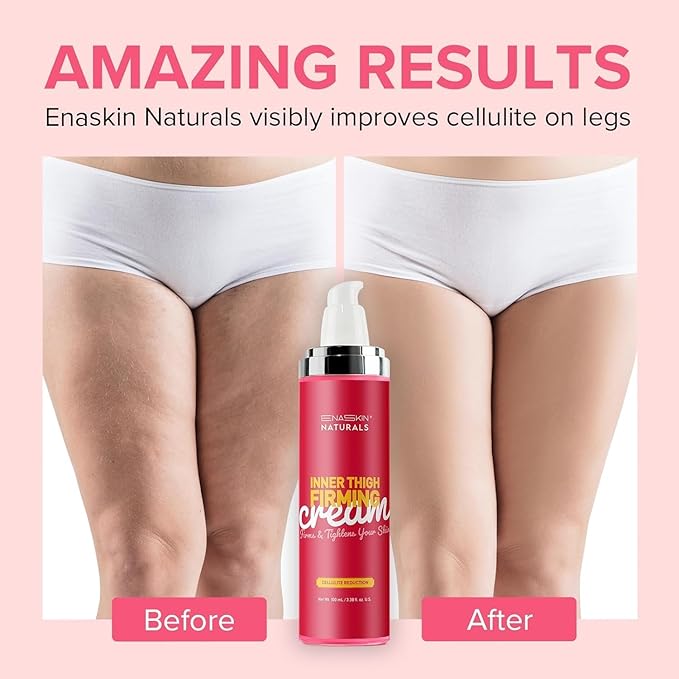 Enaskin Naturals Anti Cellulite Body Firming Cream: Cellulite Remover for Legs & Inner Thigh- Skin Tightening Lotion for Womens' Booty, Stomach & Belly with Acetyl Hexapeptide-8 & Caffeine, 100 ML