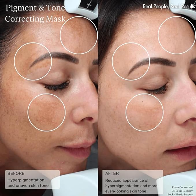 Senté Cysteamine HSA Pigment and Tone Corrector- Hyperpigmentation Treatment For Reducing The Appearance of Dark Spots And Improving Skin Tone - 1.7 Fl Oz