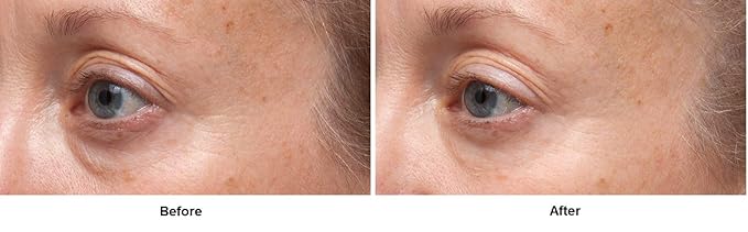 Dr Dennis Gross Ferulic + Retinol Triple Correction Eye Serum: for Wrinkles, Loss of Elasticity, and Rough Texture, 0.5 fl oz