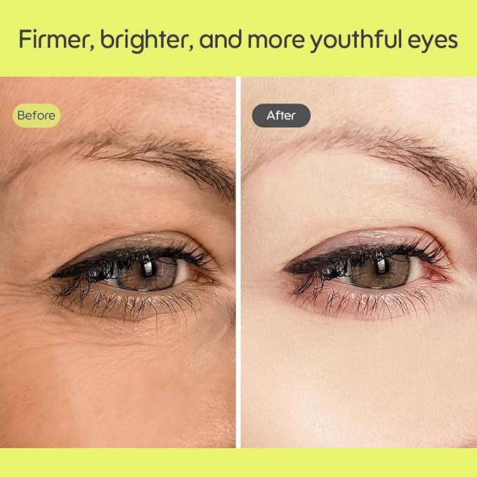 Kiero Pure Radiant Eye Cream - Lightweight & Fast-Absorbing Eye Crea for Puffiness, Bags Under Eyes & Dark Circles - Vegan, Firming Eye Moisturizer with Niacinamide & Centella Asiatica (0.85 fl oz)