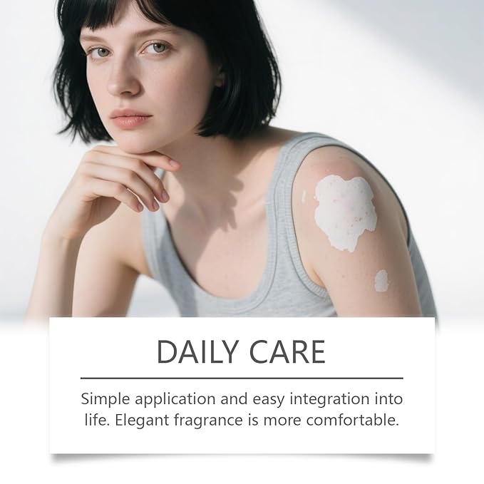 Vitiligo Cream, Vitiligo Treatment Cream， Reduce White Spots，Easy to Use