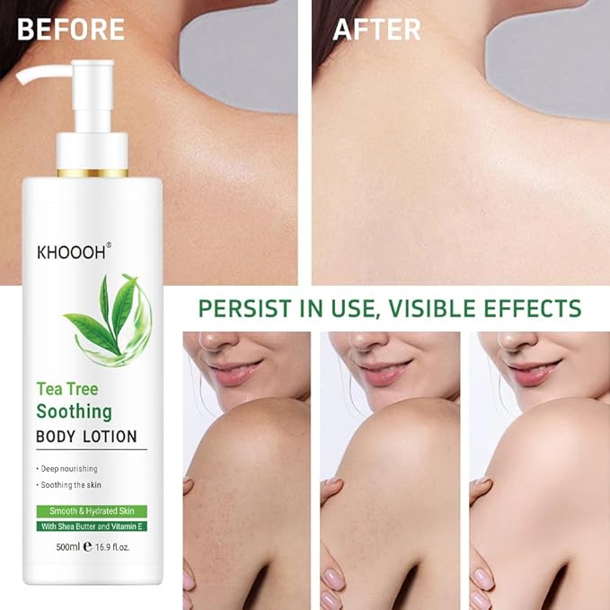 Moisturizer Skincare Dry Skin Body Lotion Intense Healing Body Lotion for Very Dry (Tea Tree)