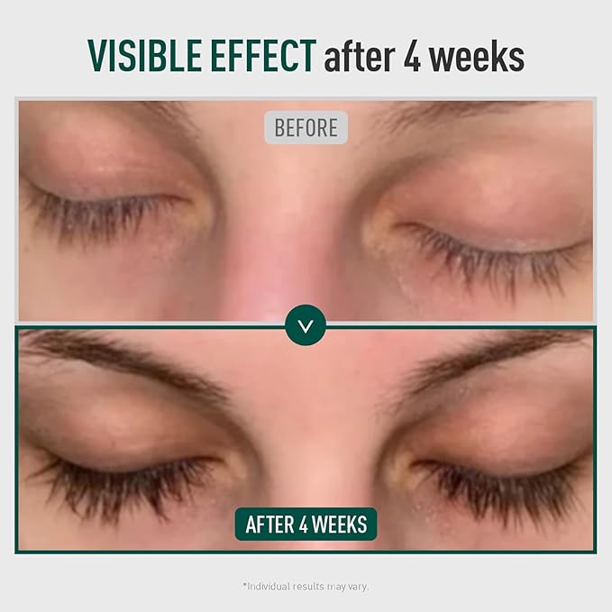 Biotin Lash Serum - Eyelash and Eyebrow Growth Serum for Thicker, Fuller Lashes and Brows, Korean Dermatologist-Developed, 0.35oz