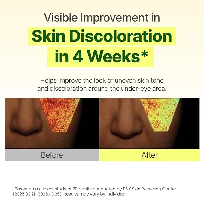 GOODAL Green Tangerine Vitamin C Dark Circle Eye Cream | Intensive Dark Circle Relief and Elasticity Treatment, Gentle, Non-irritating, Anti-Aging and Anti-Wrinkle Care 30ml