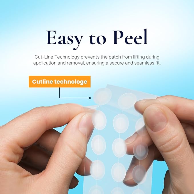 Discreet Acne Pimple Patch | Spot Cover Treatment Solution Cystic Acne Pimple Scars | Hydrocolloid Facial Stickers | Waterproof Patches Quick Healing Pimples